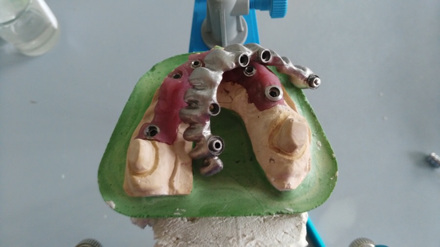 Estructura metálica 1