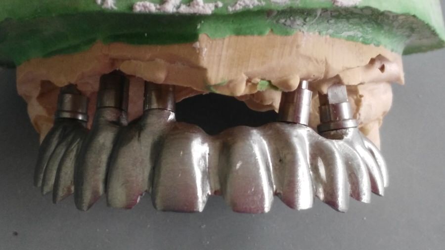 Estructura metálica 2