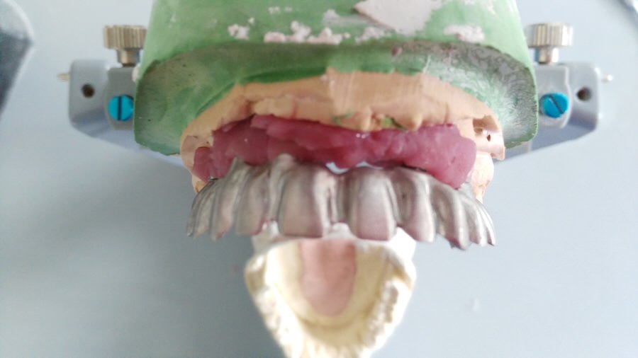 Estructura metálica 3